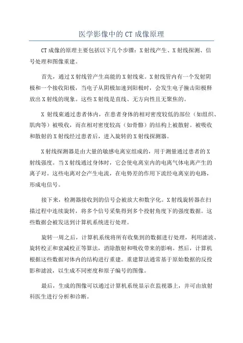 医学影像中的CT成像原理