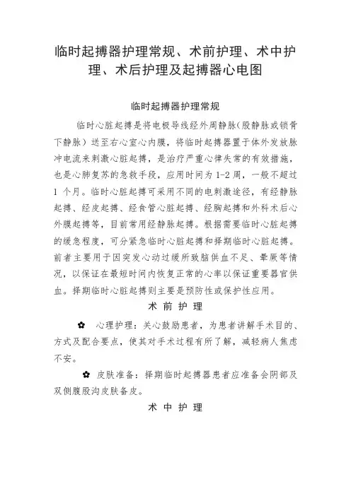 临时起搏器护理常规、术前护理、术中护理、术后护理及起搏器心电图