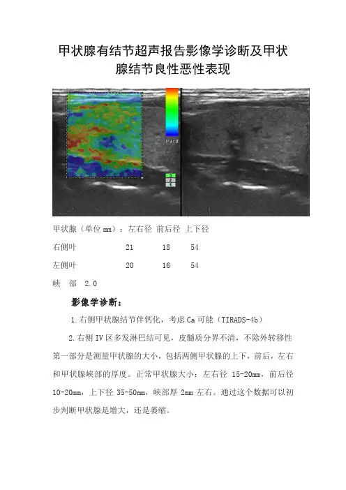 甲状腺结节超声报告影像学诊断及甲状腺结节良性恶性表现