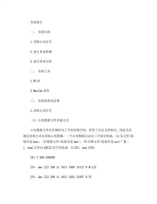 心电信号R波检测分析与处理