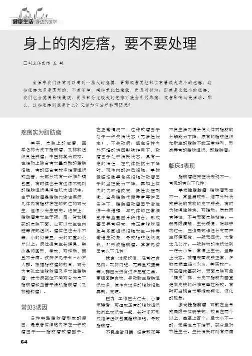 身上的肉疙瘩,要不要处理