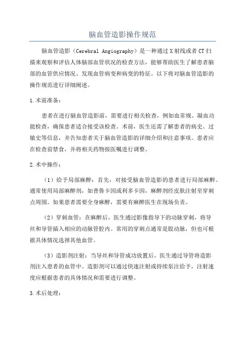 脑血管造影操作规范