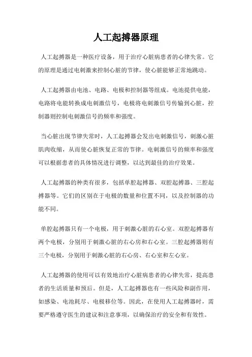 人工起搏器原理
