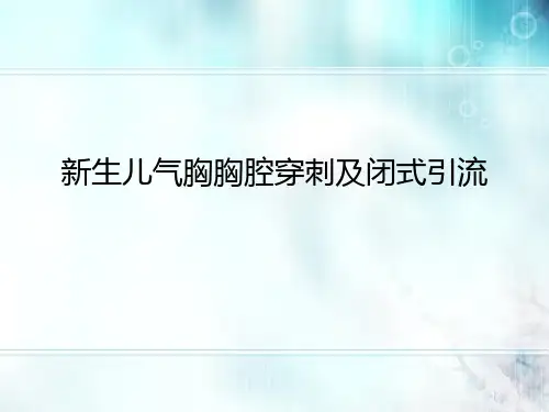 新生儿气胸胸腔穿刺及闭式引流