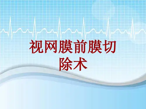 手术讲解模板：视网膜前膜切除术