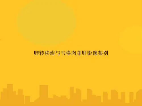 肺转移瘤与韦格肉芽肿影像鉴别PPT优秀版