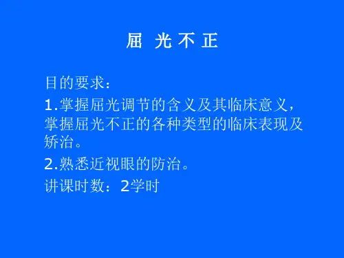 眼科学课件：屈光不正