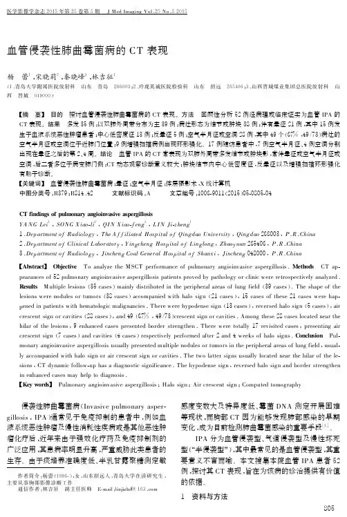 血管侵袭性肺曲霉菌病的+CT+表现