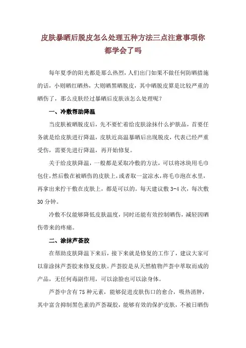皮肤暴晒后脱皮怎么处理 五种方法三点注意事项你都学会了吗