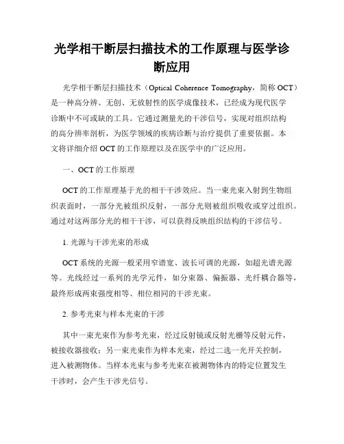 光学相干断层扫描技术的工作原理与医学诊断应用