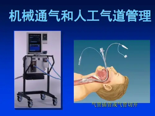 机械通气和人工气道管理
