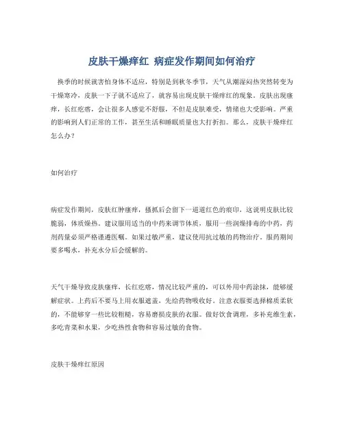 皮肤干燥痒红 病症发作期间如何治疗
