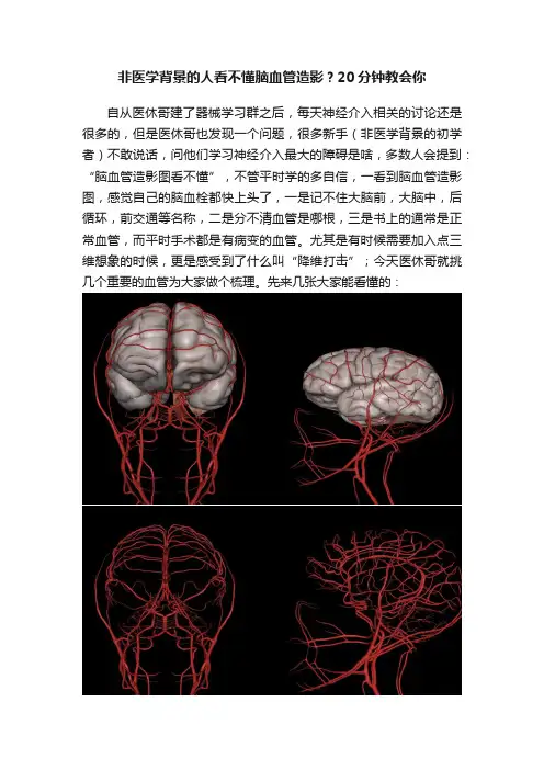 非医学背景的人看不懂脑血管造影？20分钟教会你