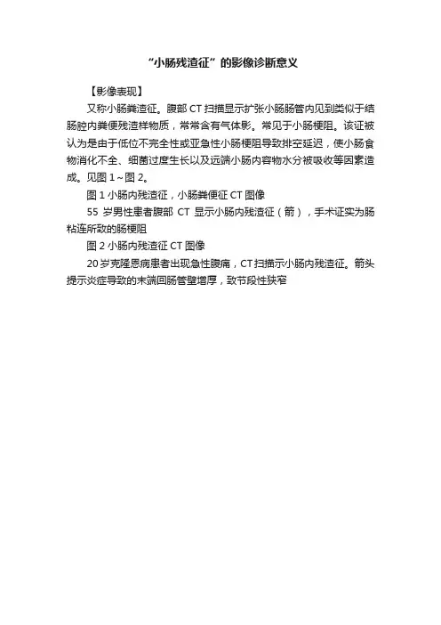 “小肠残渣征”的影像诊断意义