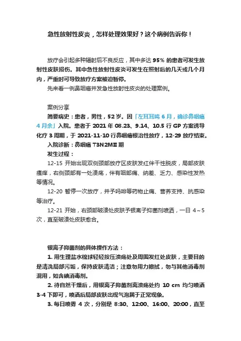急性放射性皮炎，怎样处理效果好？这个病例告诉你！