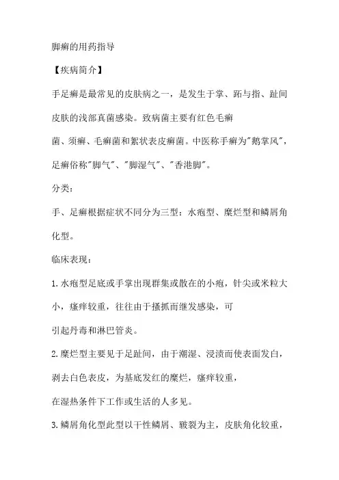 脚癣的用药指导