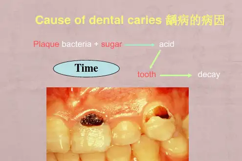 氟化物与牙健康