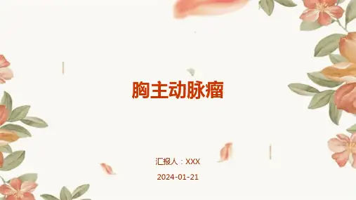 胸主动脉瘤演示课件