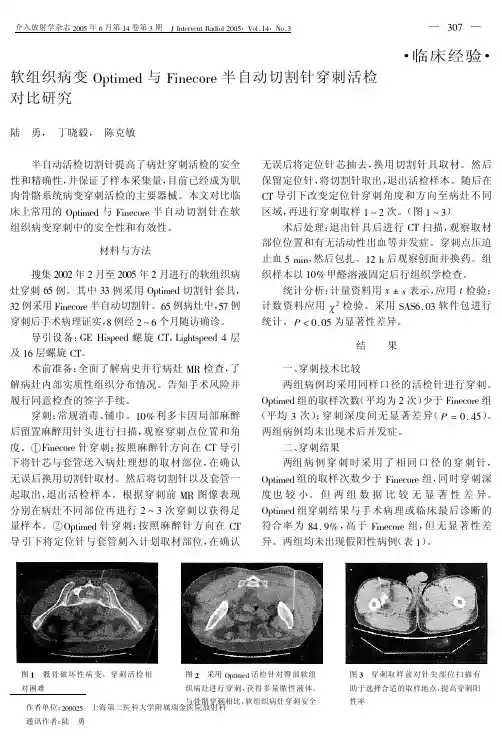 临床经验软组织病变Optimed与Finecore