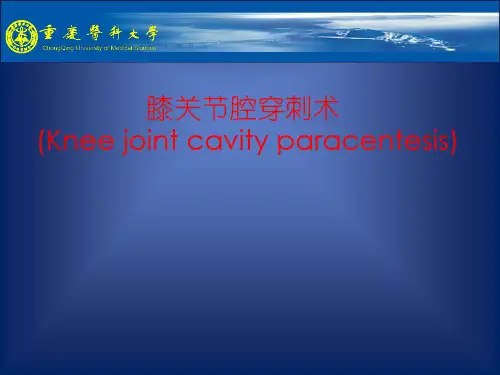 膝关节穿刺术