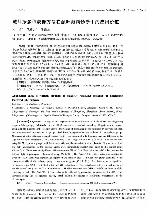 磁共振多种成像方法在颞叶癫痫诊断中的应用价值