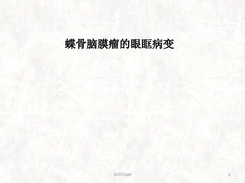 蝶骨脑膜瘤的眼眶病变ppt课件