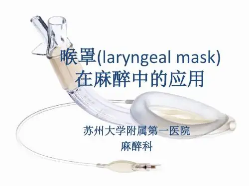 喉罩在麻醉中的应用