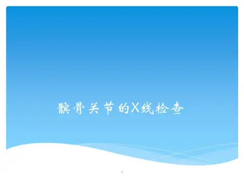 髌骨关节的X线检查ppt课件