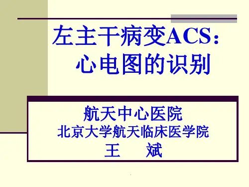 左主干病变ACS心电图的识
