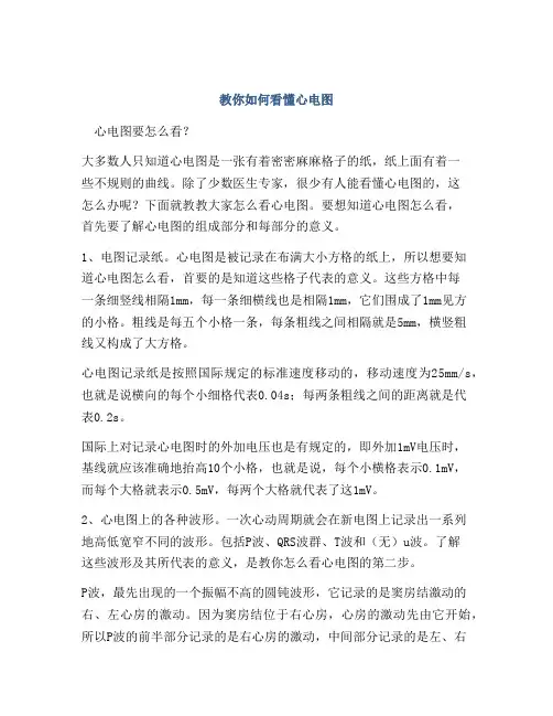 教你如何看懂心电图