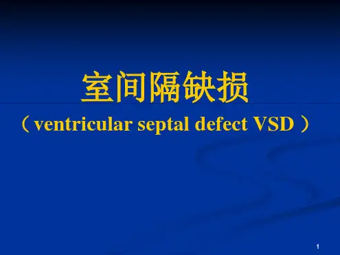室间隔缺损ppt课件[文字可编辑]