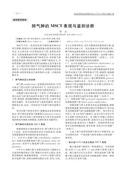 肺气肿的MSCT表现与鉴别诊断