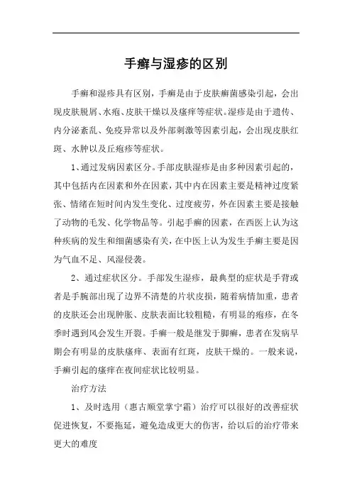 手癣与湿疹的区别