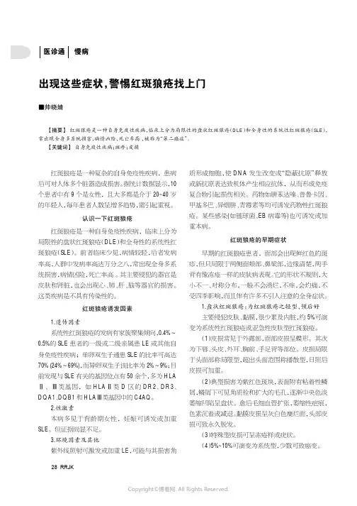 出现这些症状，警惕红斑狼疮找上门