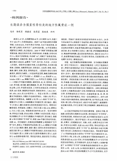 长期误诊为强直性脊柱炎的地方性氟骨症一例
