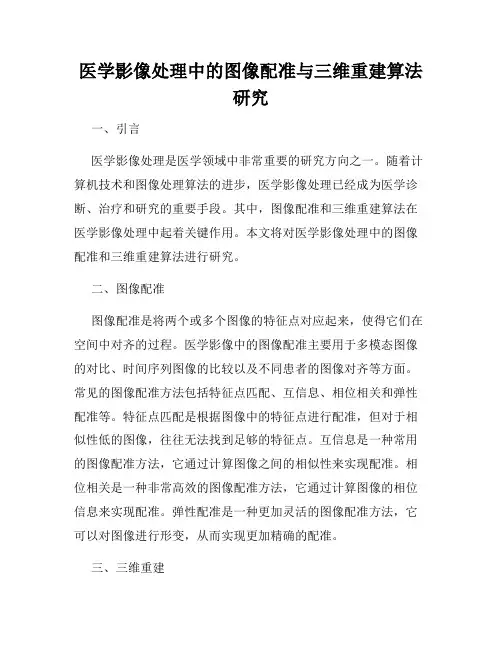 医学影像处理中的图像配准与三维重建算法研究