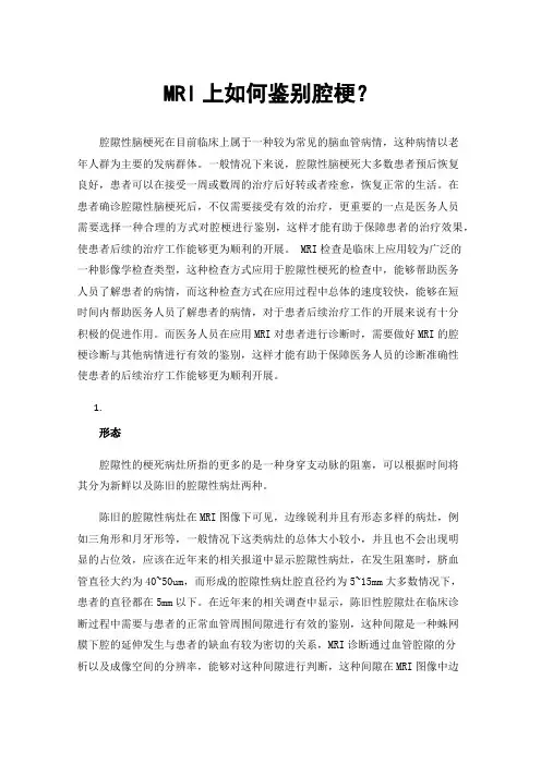 MRI上如何鉴别腔梗？