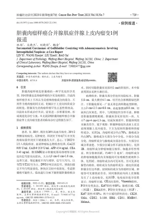 胆囊肉瘤样癌合并腺肌症伴腺上皮内瘤变1例报道