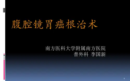 腹腔镜胃癌根治术李国新