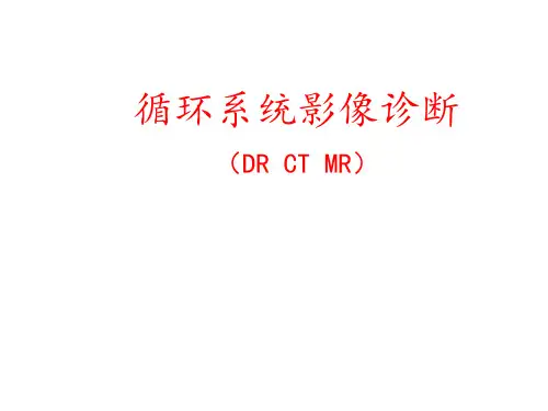 循环系统 影像学课件 循环系统影像诊断