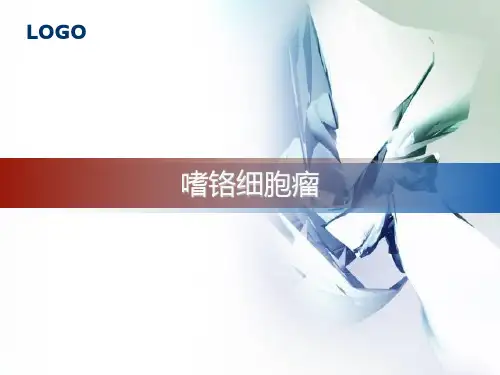 嗜铬细胞瘤