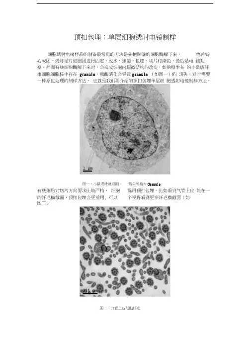 顶扣包埋：单层细胞透射电镜制样
