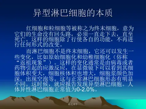 异型淋巴细胞