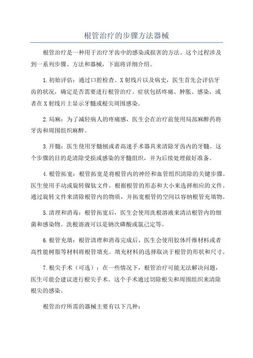 根管治疗的步骤方法器械