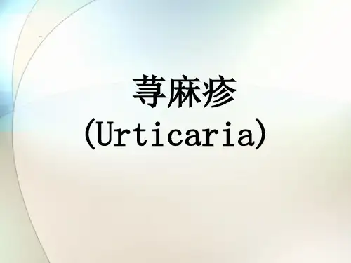 荨麻疹-ppt参考课件_2