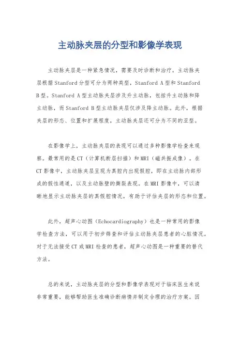 主动脉夹层的分型和影像学表现