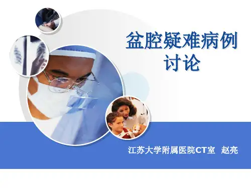 盆腔疑难病例讨论11-01