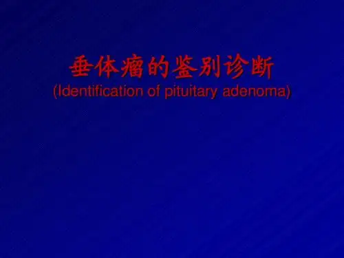 垂体瘤的鉴别诊断ppt课件