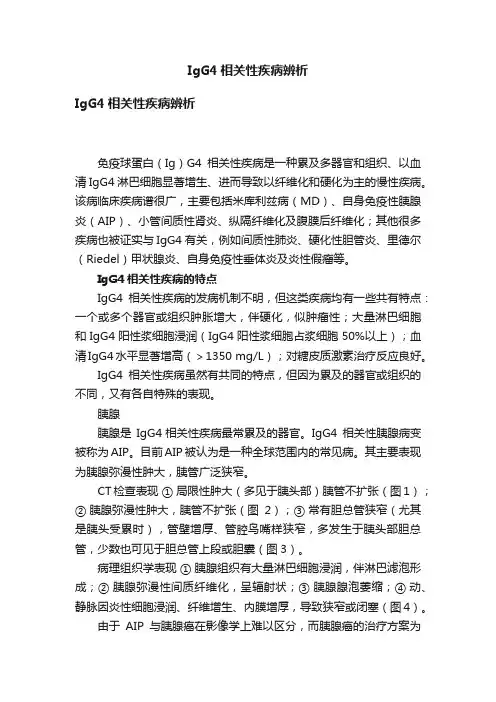 IgG4相关性疾病辨析