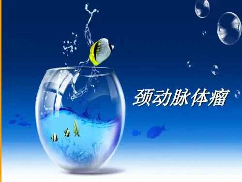 颈动脉体瘤